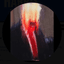 Susan Anderson