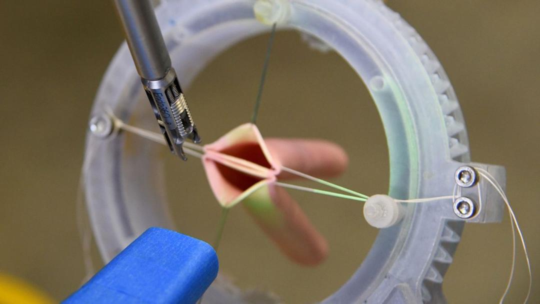 Robot Performs Surgery Autonomously With 100% Success Rate