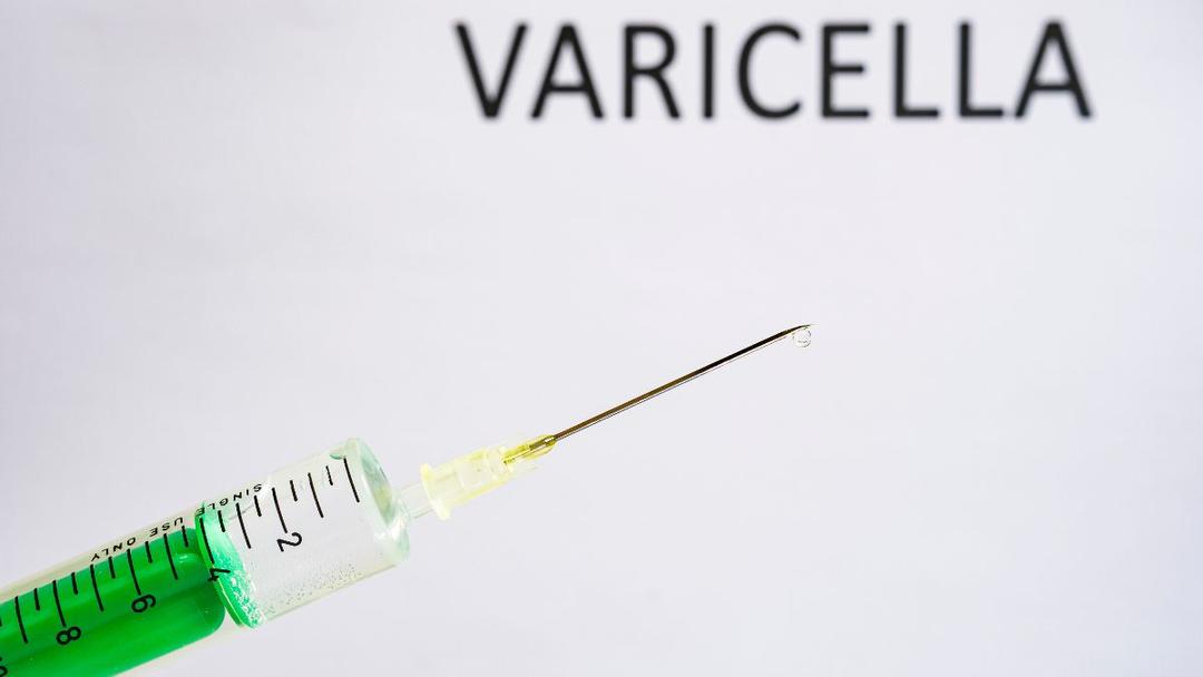 NHS to Offer Free Chickenpox Vaccine in England from January