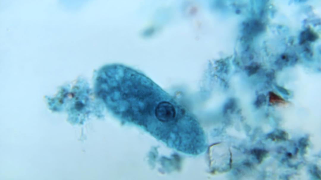 AI Model Helps Discover Targeted Antibiotic for Crohn's Disease