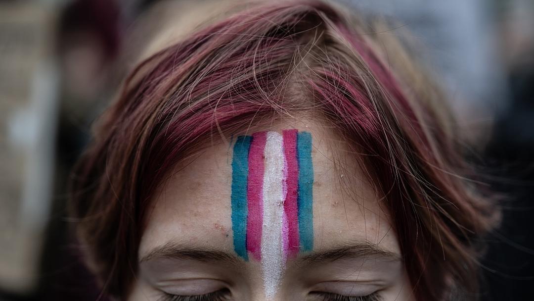 Plastic Surgeons Recommend Delaying Gender Surgery to 19