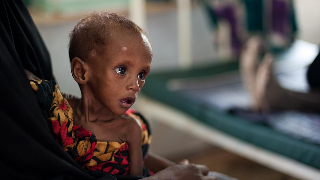 UN: 4.9M Children Under Five Died in 2024