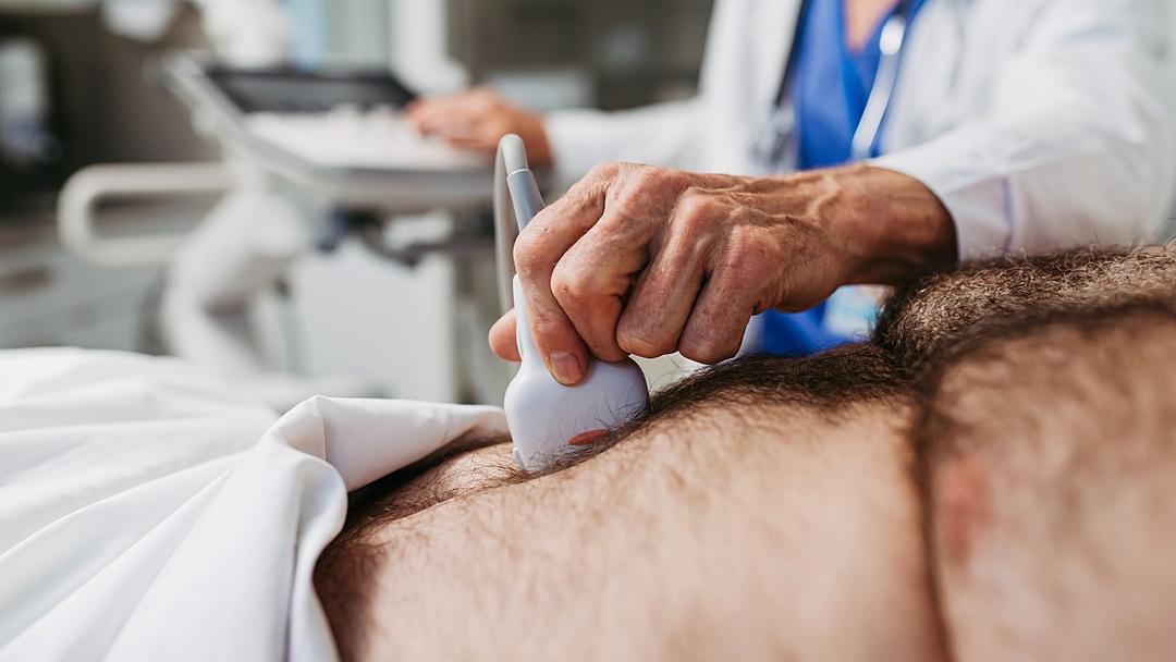 Fatty Liver Disease Affects 1.3B Worldwide