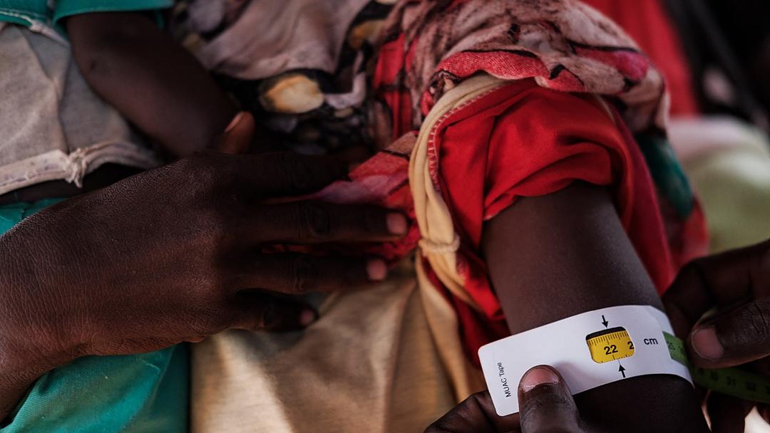 Report: 7.8M Face Hunger in South Sudan