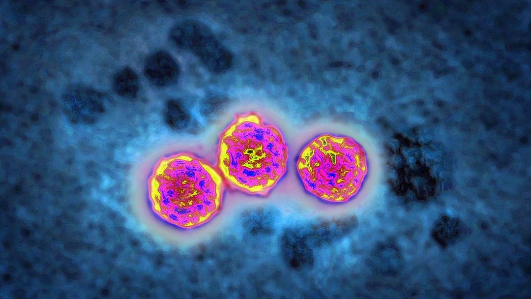 GSK Drug Shows Potential Cure for Chronic Hepatitis B