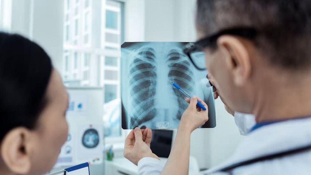 UK: NICE Approves Lung Perfusion Device for NHS Use