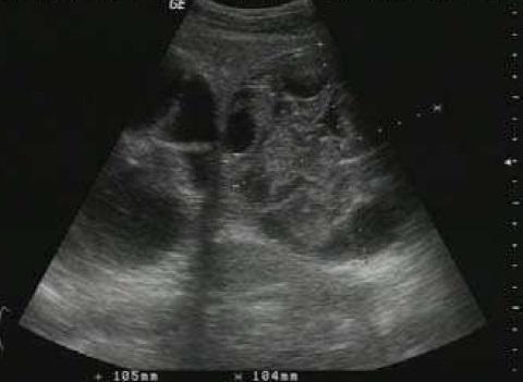 China Performs Remote Liver Surgeries via Satellite