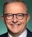 Anthonyalbanese